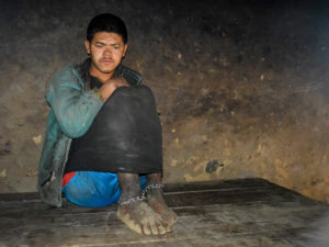With Doctors and Money in Short Supply, Mentally Disabled Suffer in Rural Nepal