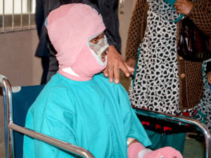Nepalese Seek Compensation, Free Treatment for Those Attacked With Acid